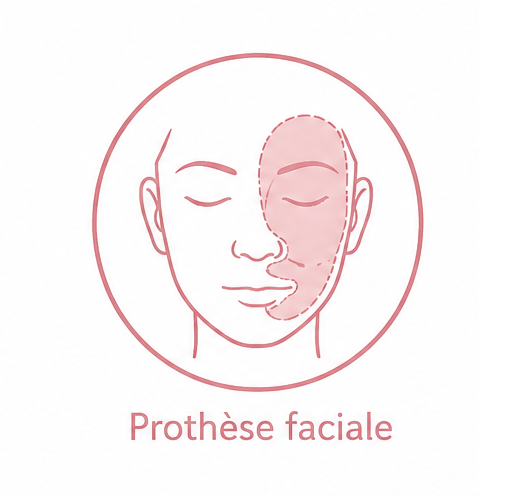 Prothèse faciale
